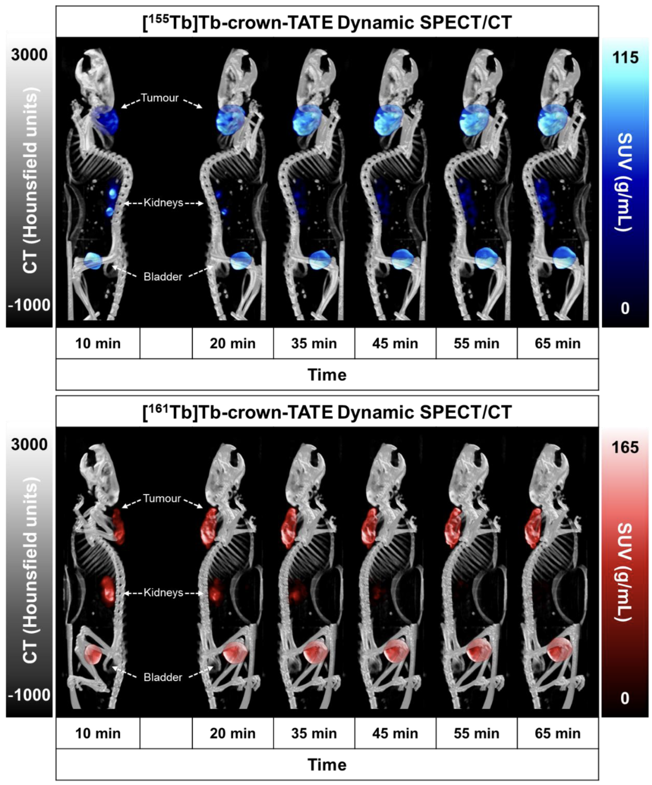 Side-by-side SPECT/CT images of the matched terbium-155 (imaging) and terbium-161 (therapy) crown-TATE pair in tumour-bearing mice.